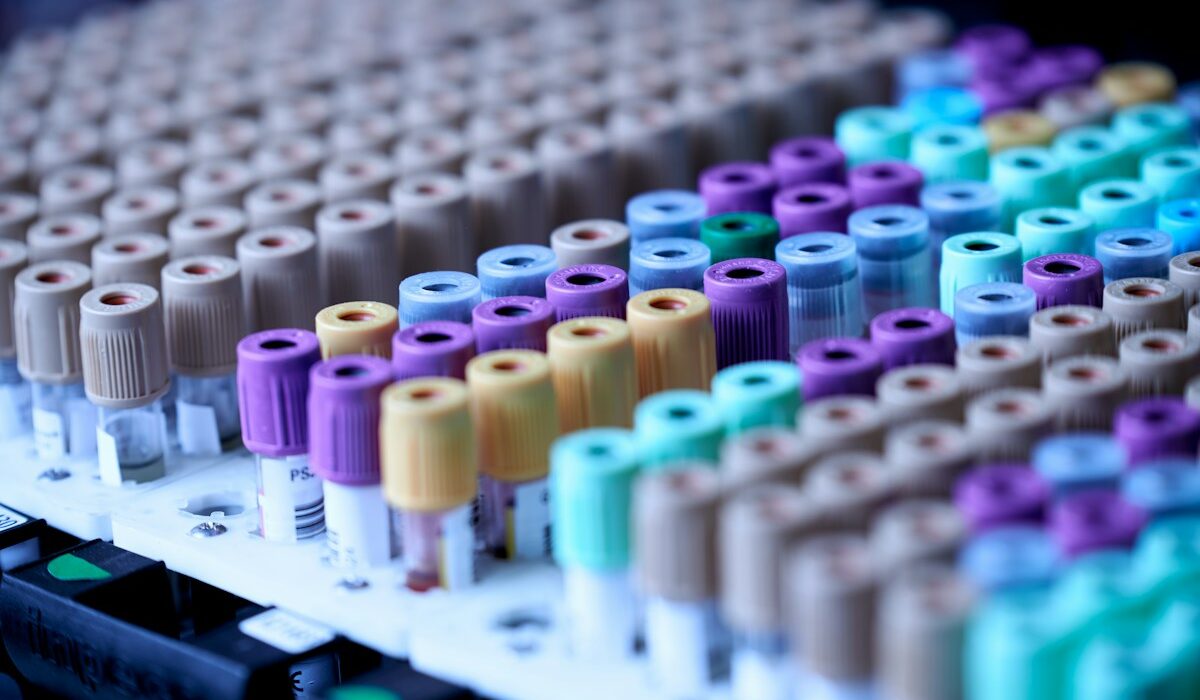 Blood sample tubes representing Quest Diagnostics laboratory testing