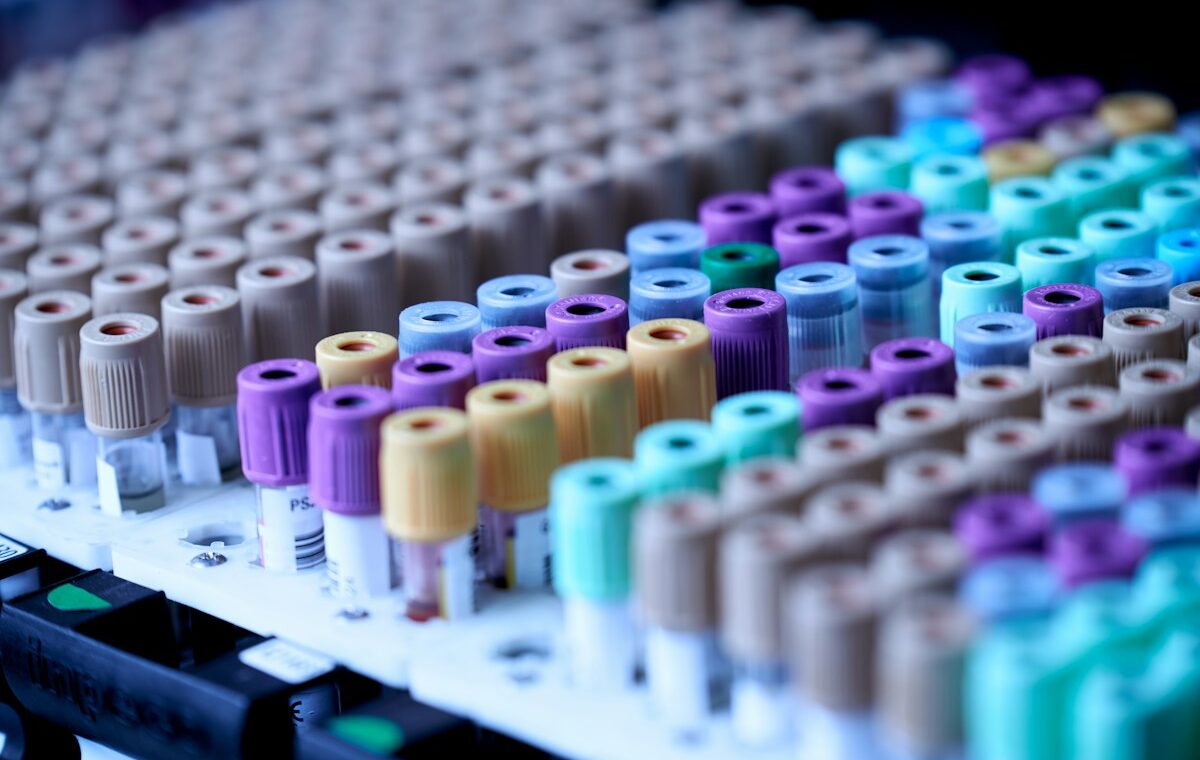 Blood sample tubes representing Quest Diagnostics laboratory testing