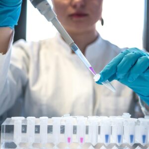 Scientist pipetting samples during antibody research